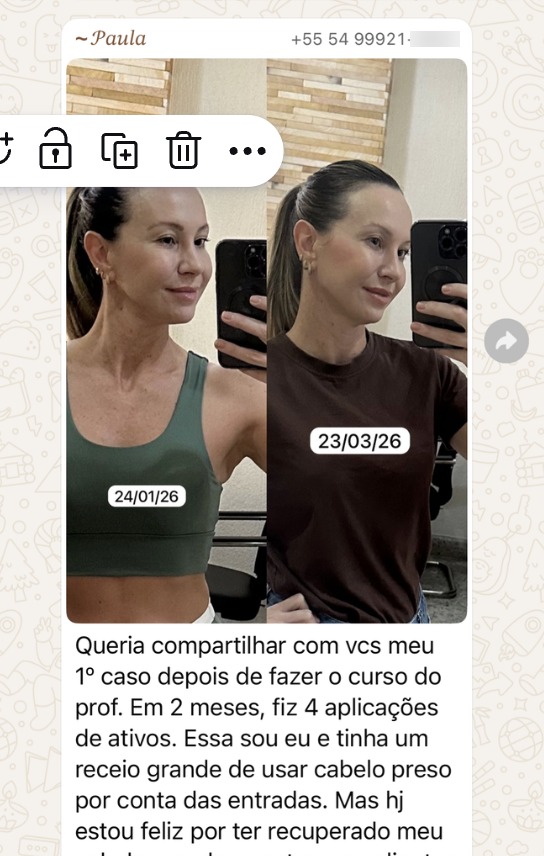 Resultado real — 4 sessões