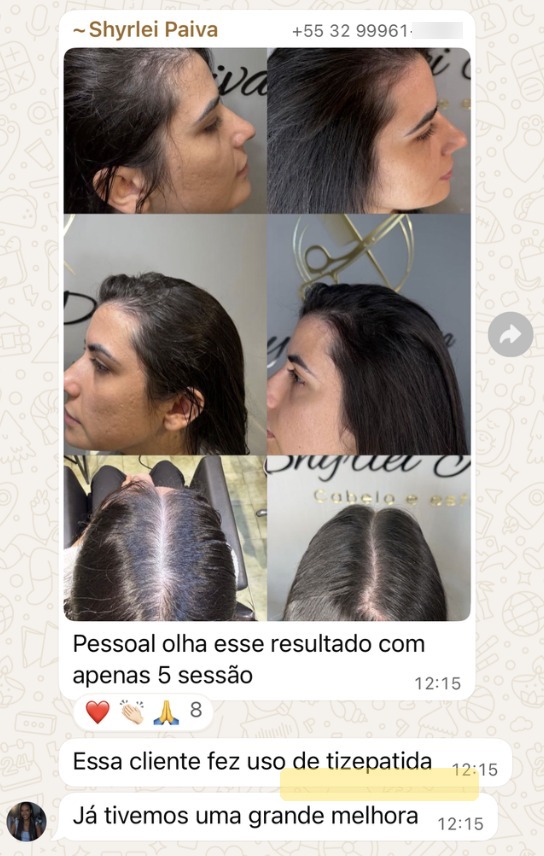 Resultado real — 5 sessões
