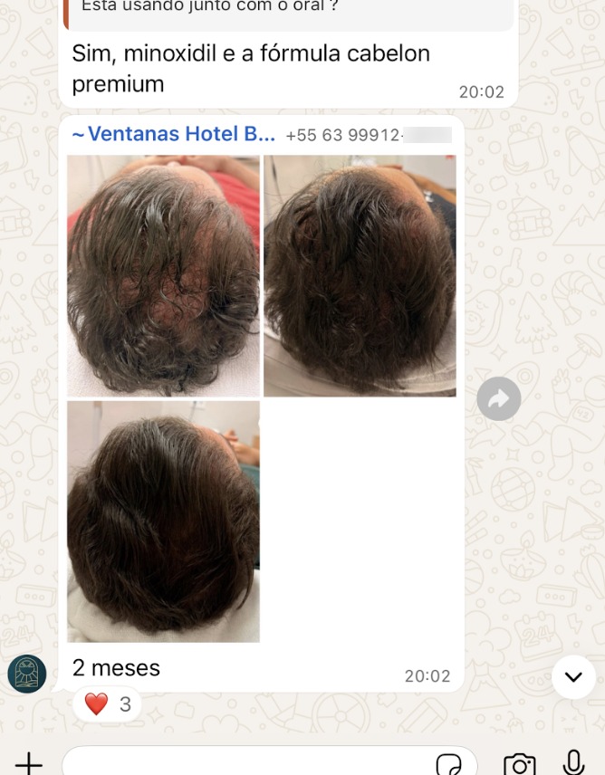 Resultado real — 60 dias