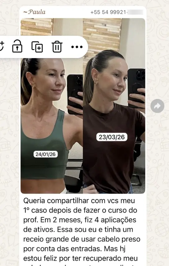 Resultado real — 4 sessões